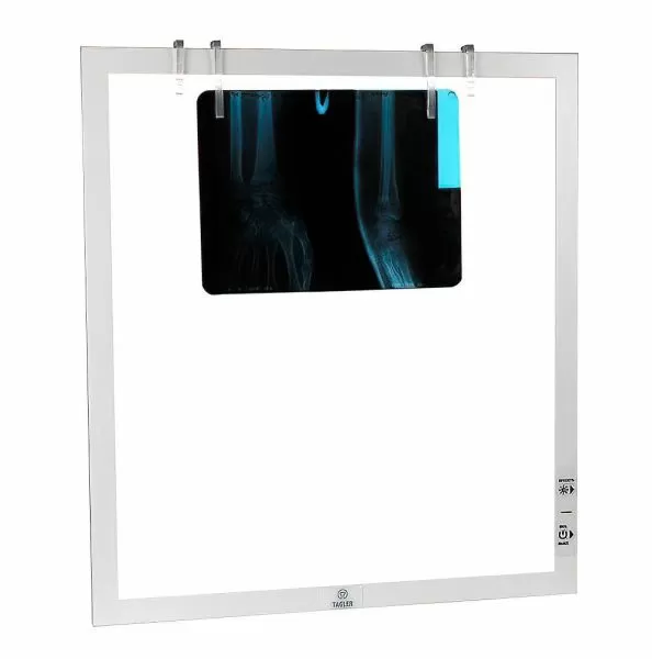 Негатоскоп TAGLER НСД-1 1-кадровый светодиодный